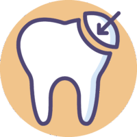 White composite fillings icon for OC Dental Center in Santa Ana California