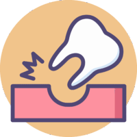 Wisdom teeth removal icon for OC Dental Center in Santa Ana California