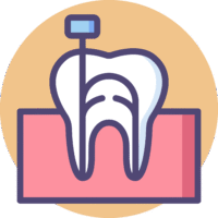 Root canal treatment icon for OC Dental Center in Santa Ana California