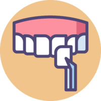 Dental veneer icon representing cosmetic veneer treatments at OC Dental Center in Santa Ana