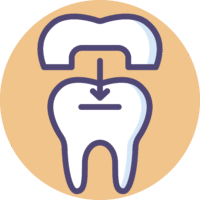 Dental crown icon representing high-quality dental crowns offered at OC Dental Center in Santa Ana
