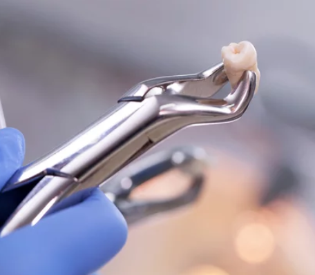 a dentist holding a removed tooth in the pliers
