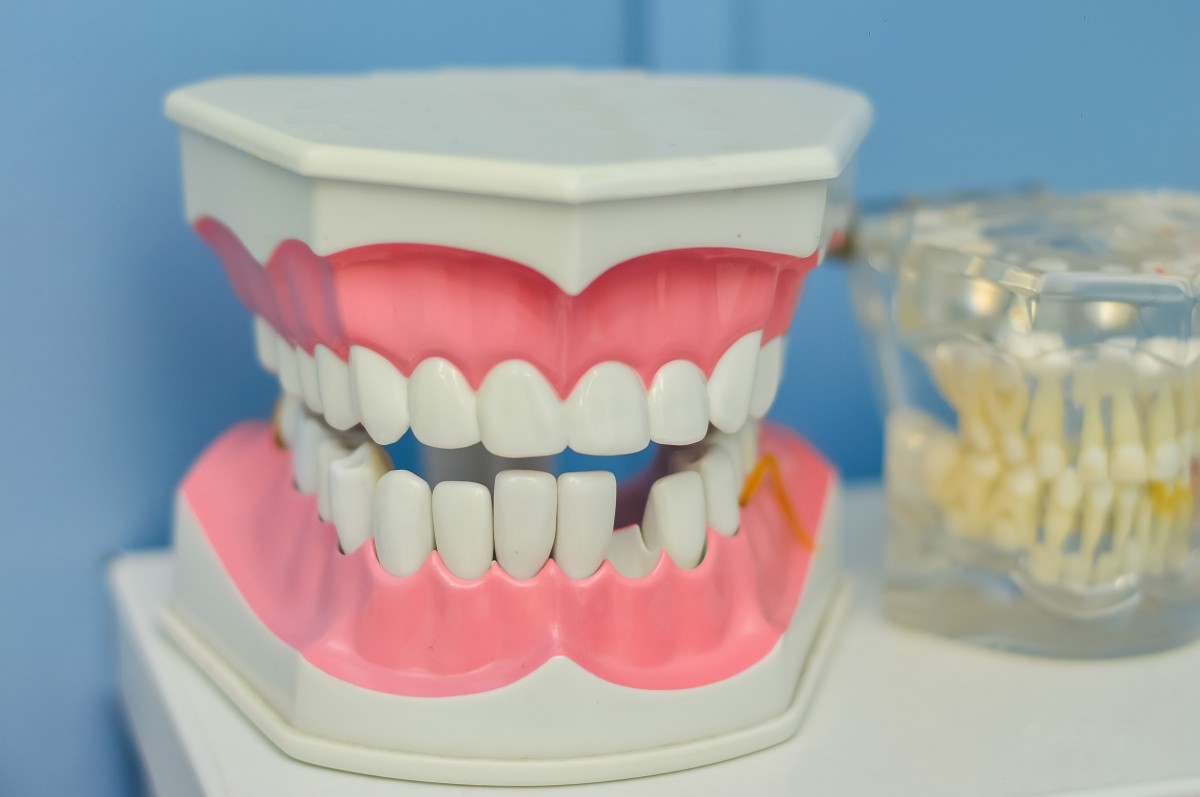 a teeth model n the dentist's office