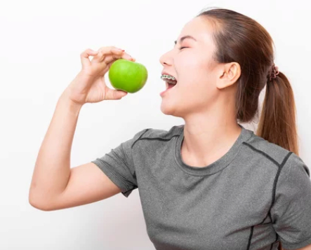 a woman with braces holding an apple
