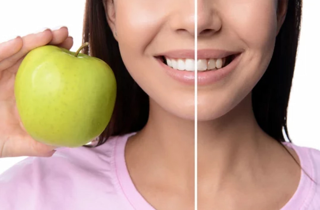 a person with smile makeover holding an apple