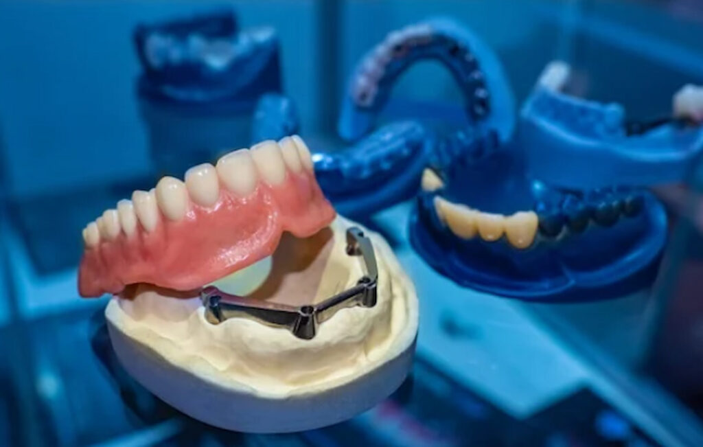 dental implants and dentures exposed in a dentist's office
