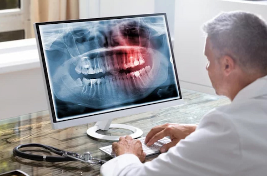 a person looking at the jaw x-ray on the monitor