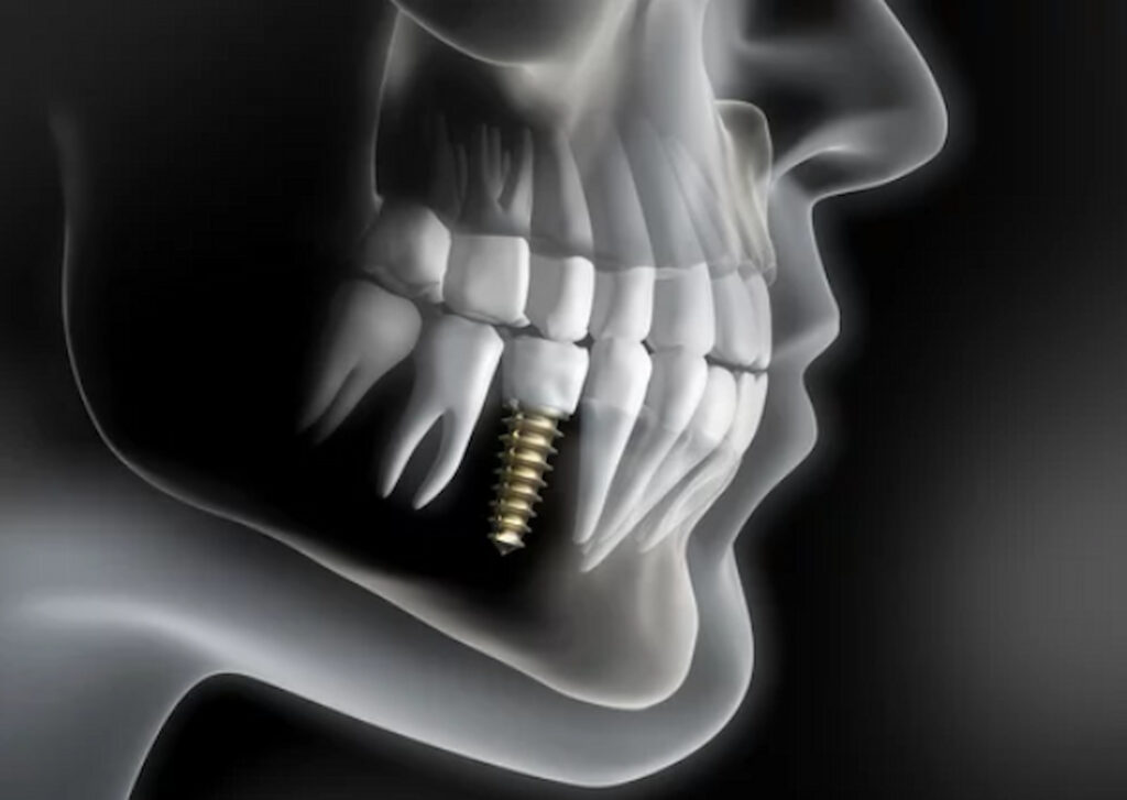 mouth and teeth x ray illustration