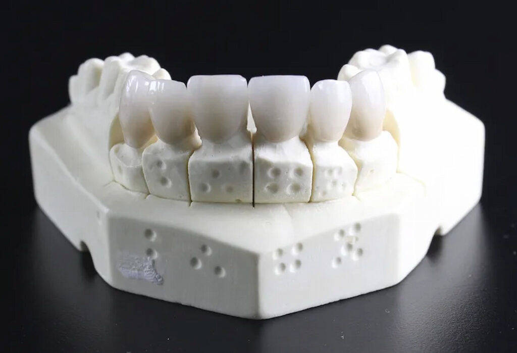 white teeth model on the dark background