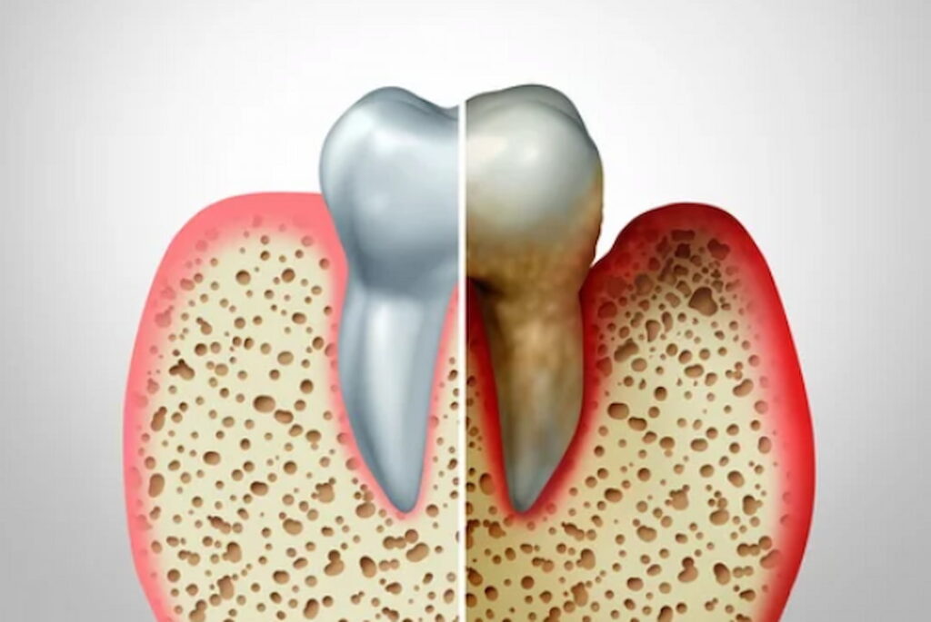 a tooth and a bone graphic illustration
