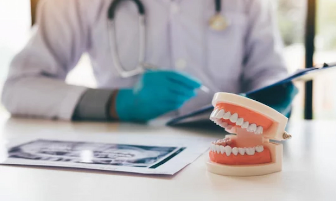 Signs of Dental Implant Rejection OC Dental Center