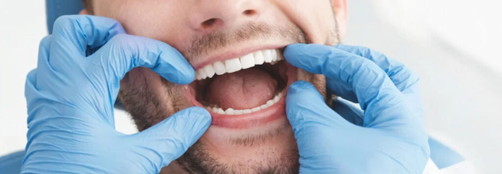 a man at the dental exam