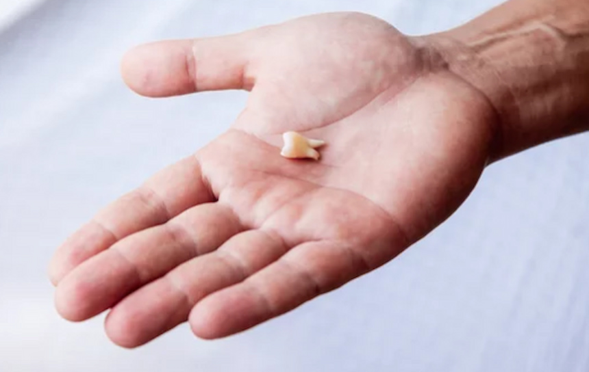 a person holding a tooth in the hand