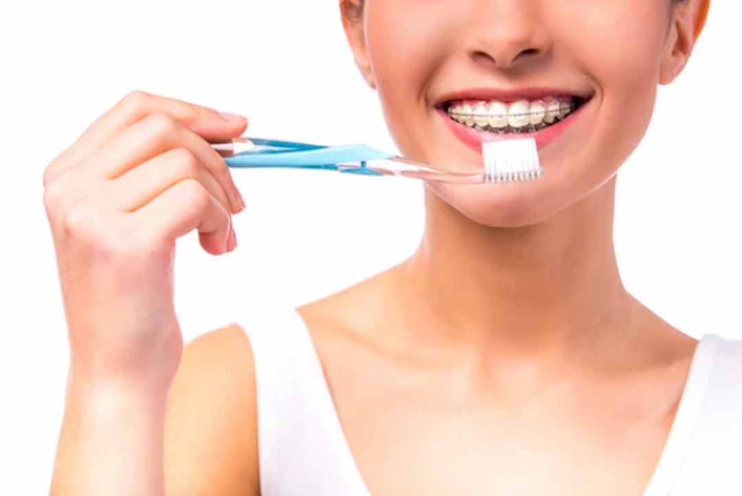 a woman with braces holding a toothbrush