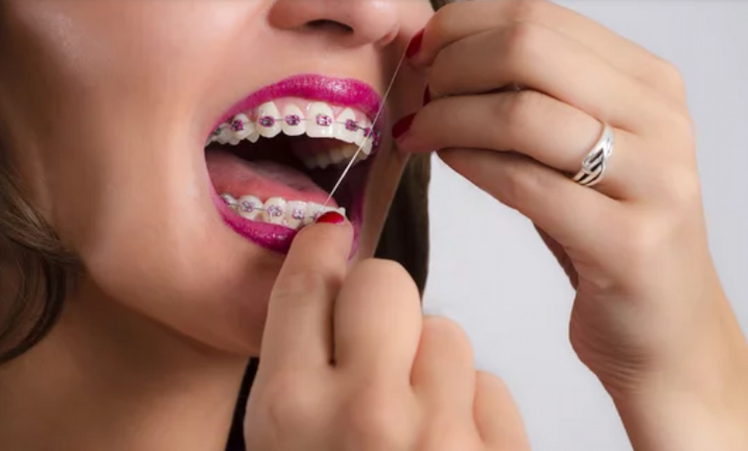 a woman with braces flossing