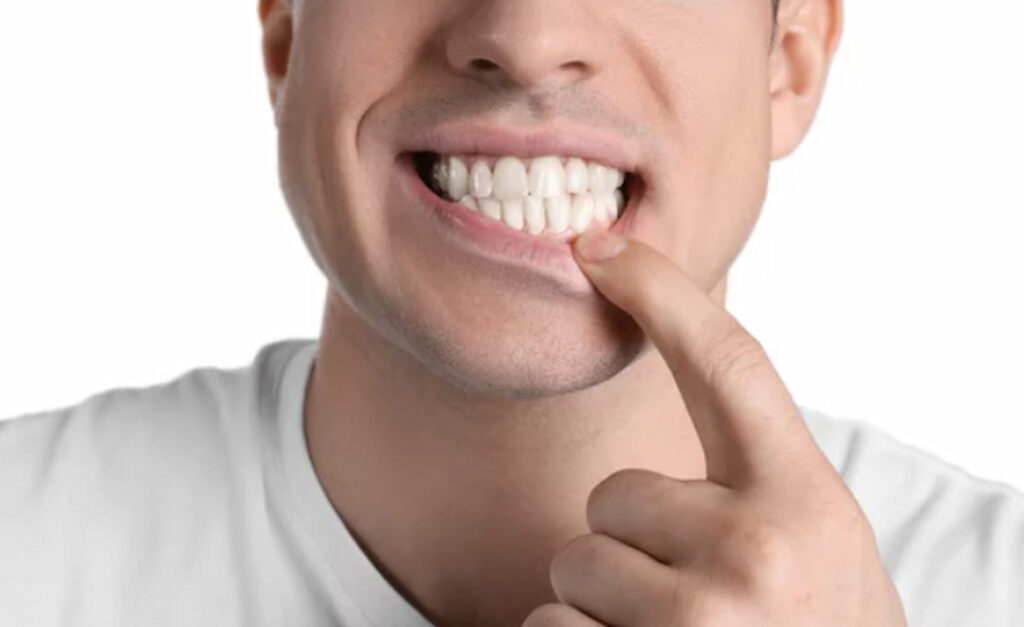 closeup of person's teeth