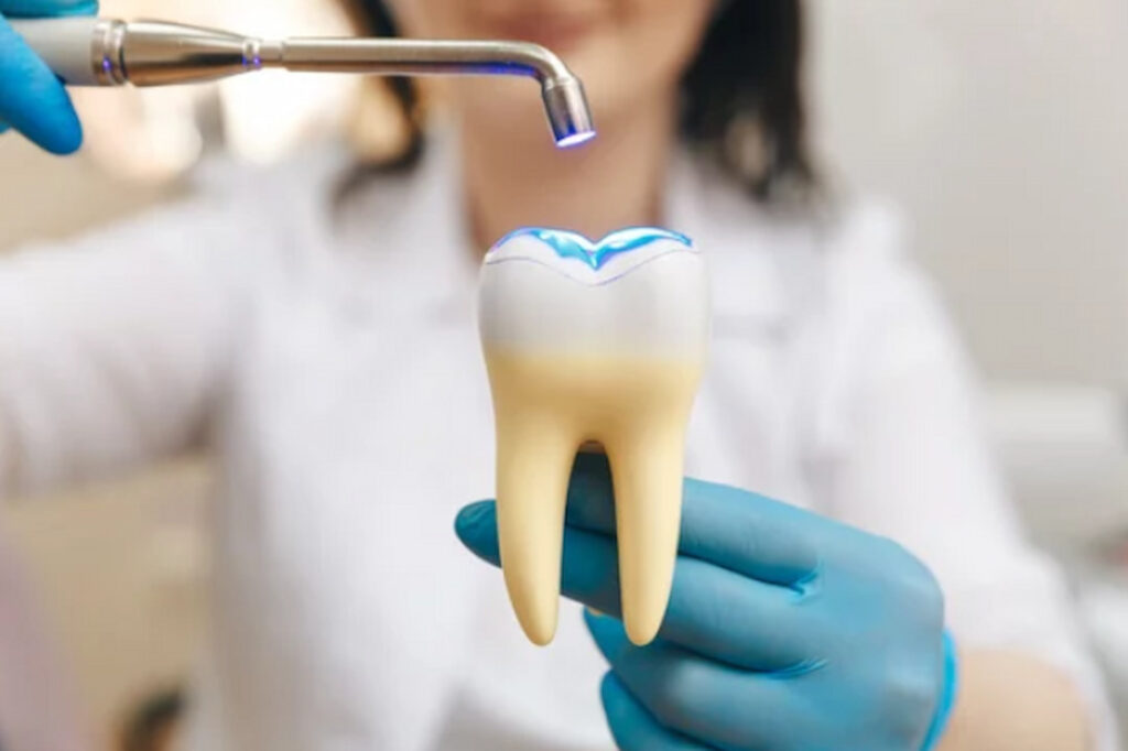 demonstration of cavity filling on a tooth model