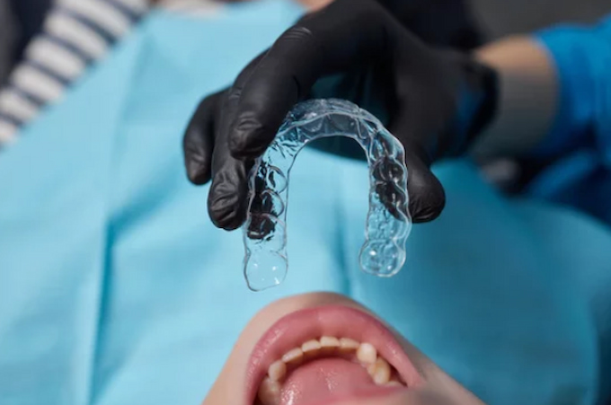 putting the aligner on in the dentist's office