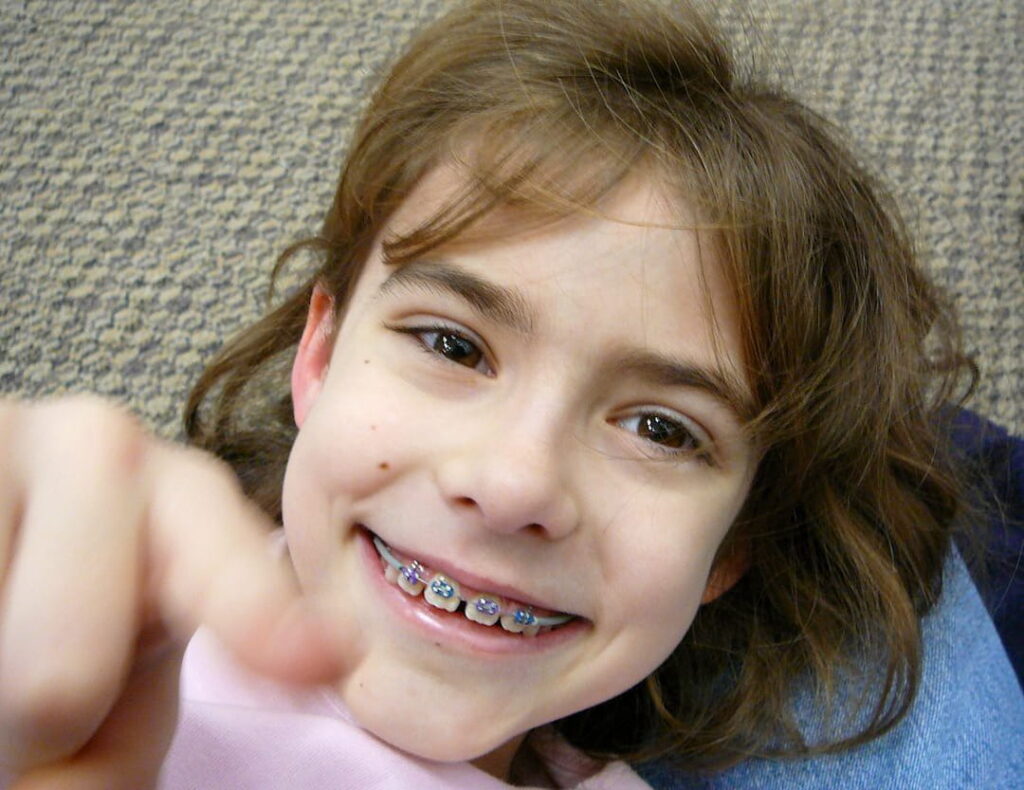 a smiling child wearing braces