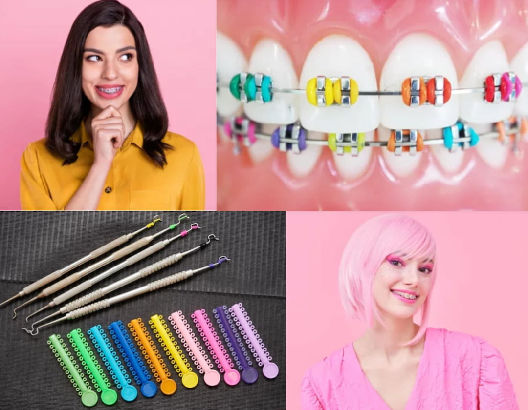 girls and various colors braces