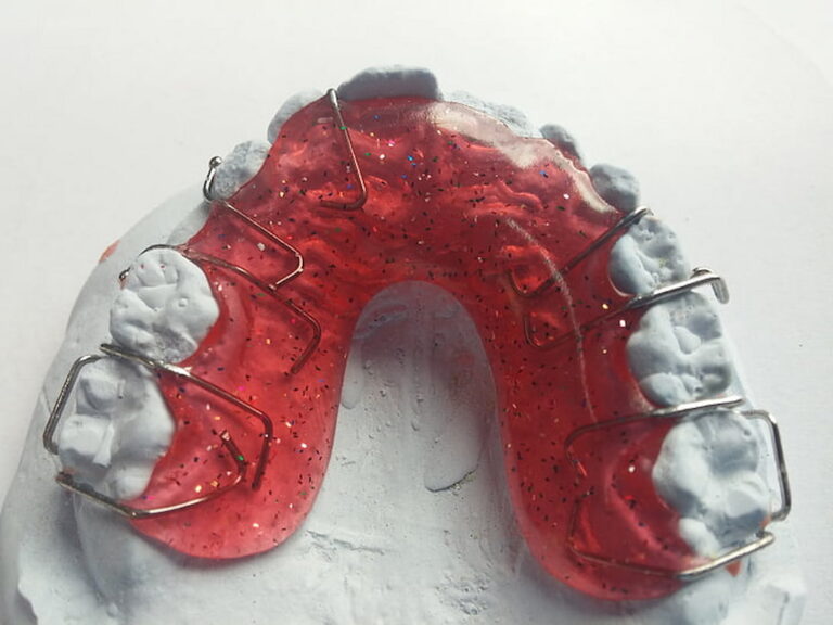 How to Tighten Retainer OC Dental Center