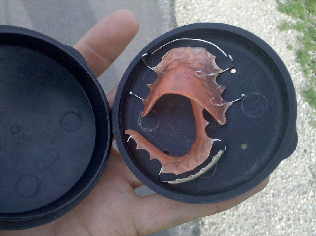 What Does a Retainer Do? OC Dental Center