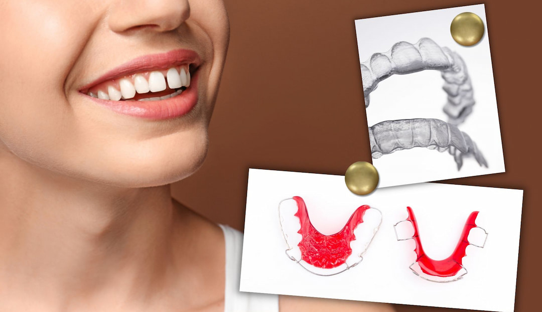 Do Retainers Close Gaps? OC Dental Center