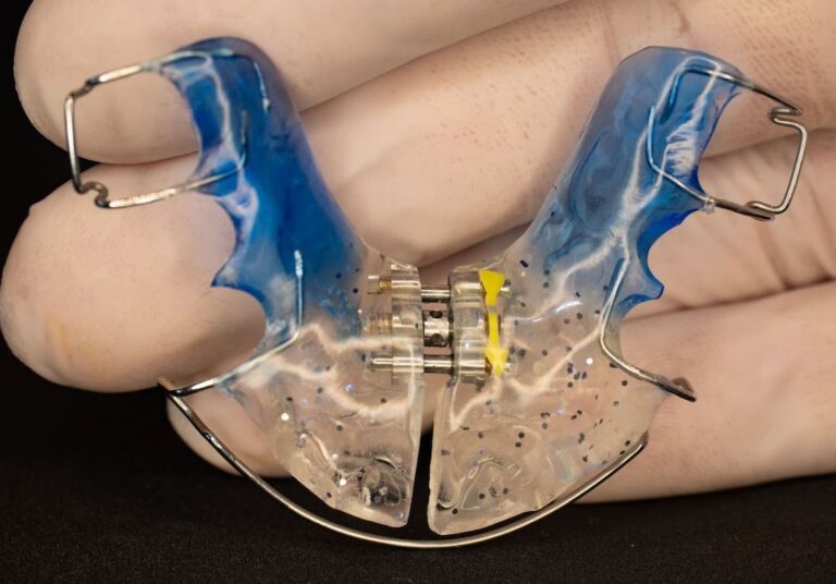 How Much Do Retainers Cost? OC Dental Center