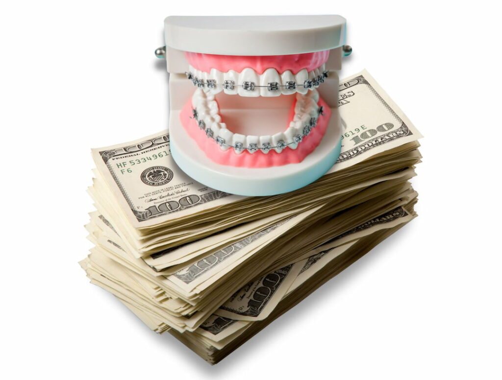 a stack of dollar bills and teeth model with braces