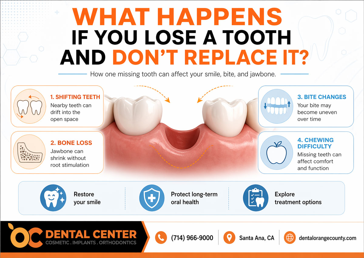 What Happens If You Lose a Tooth | Missing Tooth Replacement Santa Ana