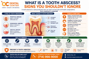 Tooth Abscess Symptoms and Treatment | Emergency Dentist Santa Ana