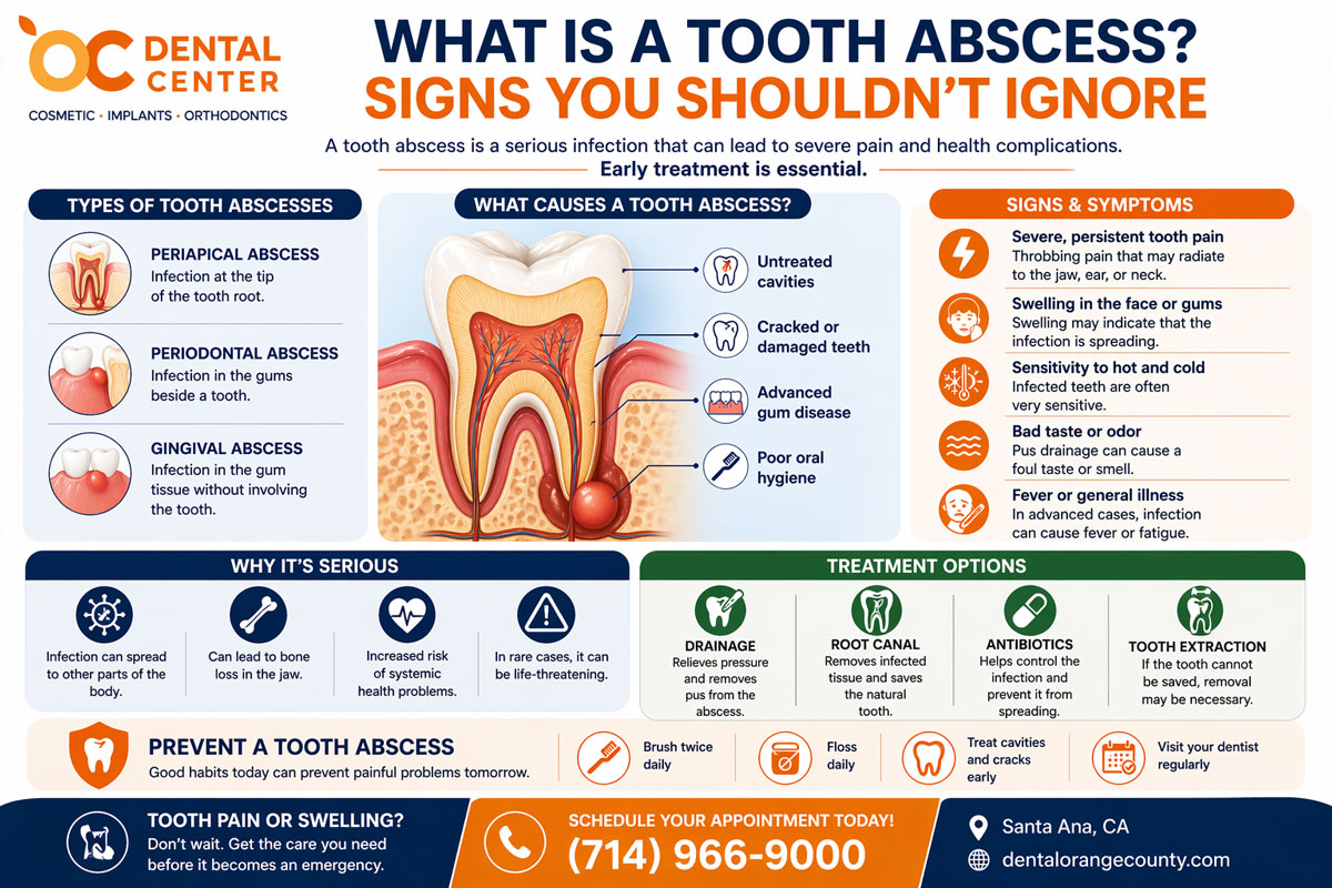 Tooth Abscess Symptoms and Treatment | Emergency Dentist Santa Ana