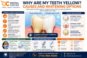 Why Are My Teeth Yellow | Causes and Teeth Whitening Santa Ana