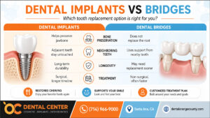 Dental Implants vs Bridges | Tooth Replacement Options Santa Ana