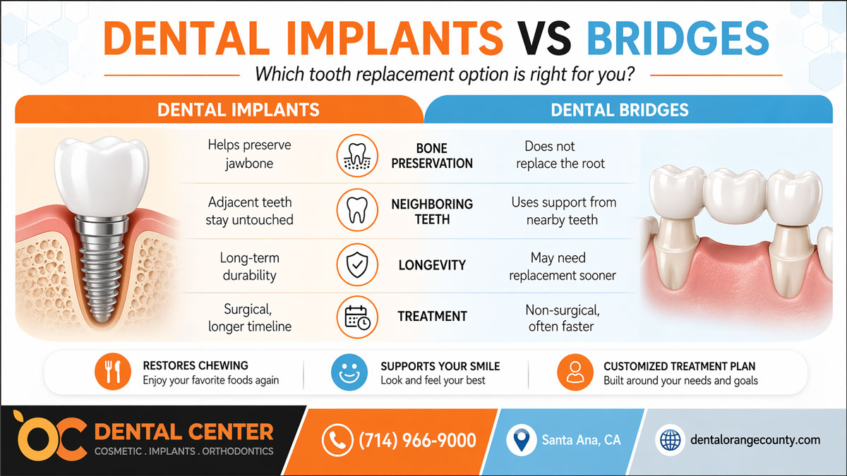 Dental Implants vs Bridges | Tooth Replacement Options Santa Ana