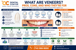 What Are Dental Veneers | Pros and Cons Santa Ana Cosmetic Dentist