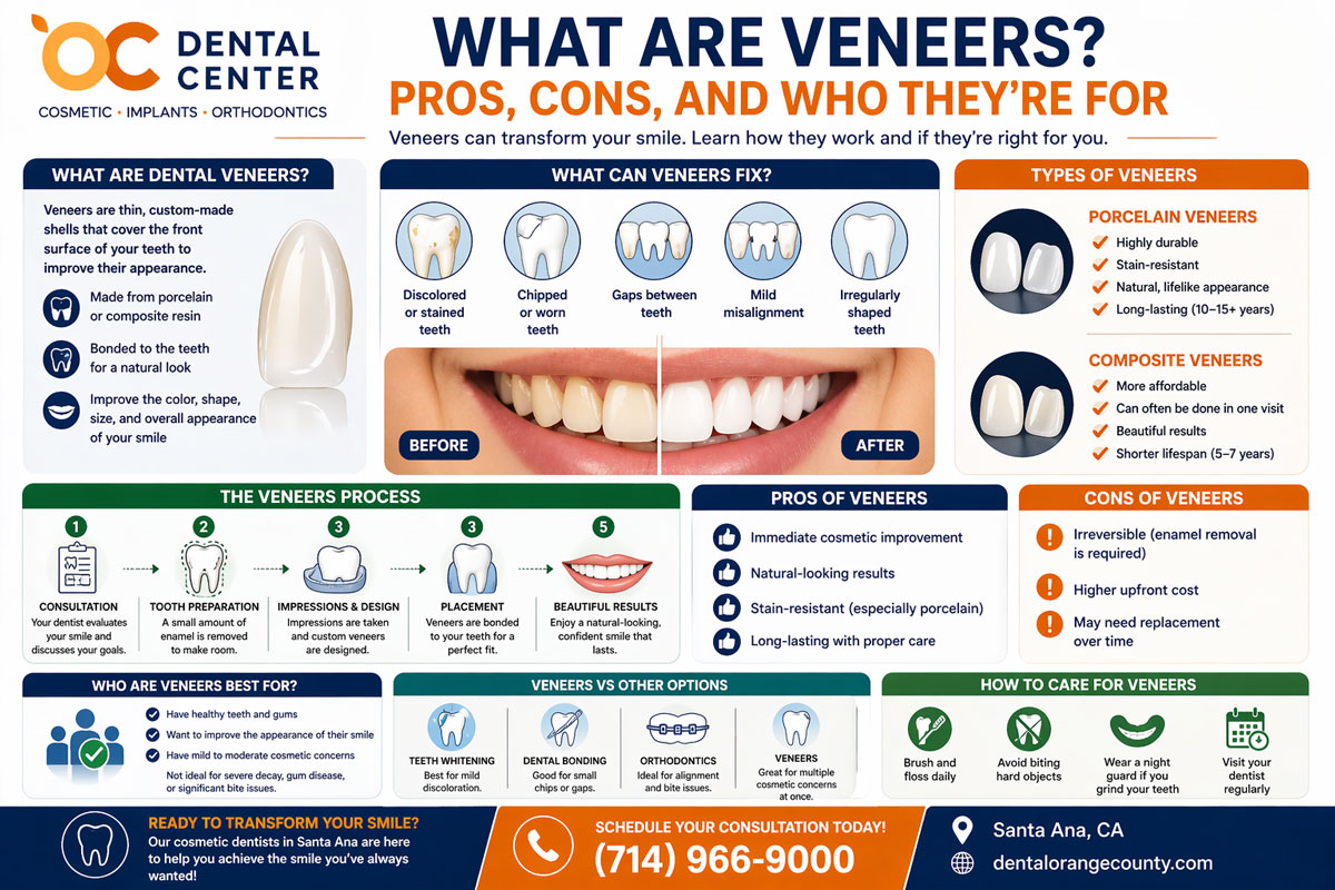 What Are Dental Veneers | Pros and Cons Santa Ana Cosmetic Dentist
