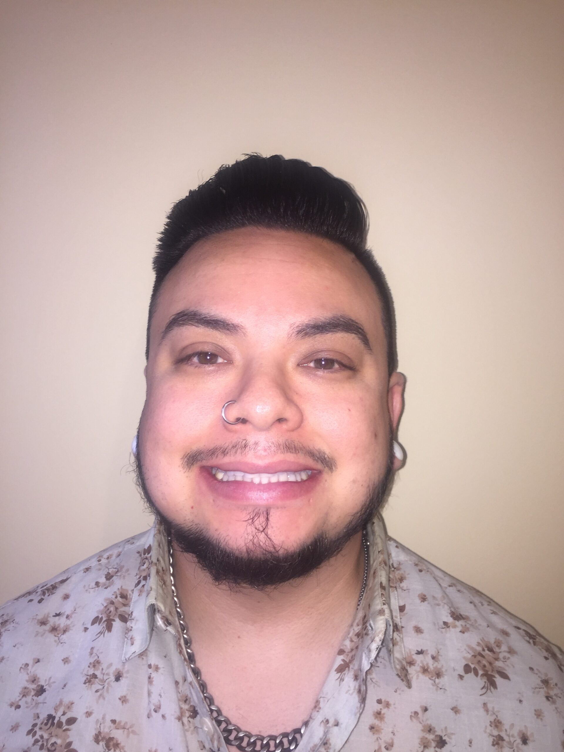 Another OC Dental Center patient smiling after veneer treatment
