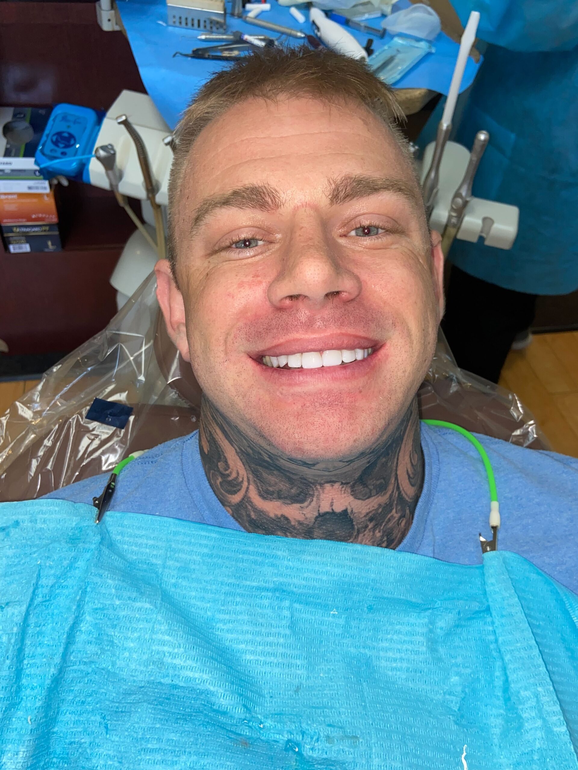 OC Dental Center patient smiling after veneer treatment