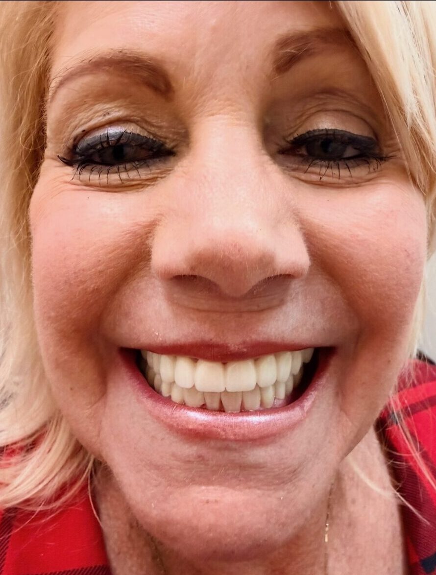 Second OC Dental Center patient smiling after treatment